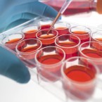 Scientists pipette fluid into stem cell cultures: Researchers have discovered that cardiac stem cells can help patients prevent heart failure after severe heart attacks.