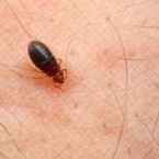 Beneath the visible hairs, the human body has even tinier hairs that help people detect bedbugs crawling on them.