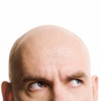 Given the principles of evolution, some scientists argue that men prone to baldness should have died off over time.