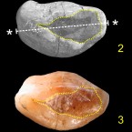Within the dotted yellow lines, a beeswax filling can be seen in the cavity of this newly discovered 6,500-year-old tooth.